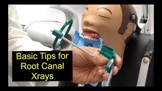 Basic Tips for Root Canal Xrays [upl. by Nayb]