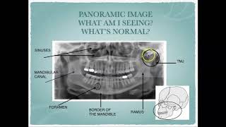 Radiographic Interpretation of Dental Anatomy [upl. by Ettenom]