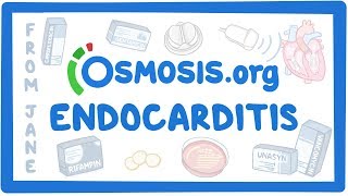 Clinicians Corner Endocarditis [upl. by Lot366]