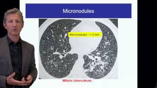 ECN PID cours 1 DFASM1 Diagnostic des PID Pr V Cottin Lyon [upl. by Nahtaj]