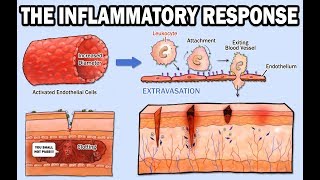 THE INFLAMMATORY RESPONSE [upl. by Yoccm]