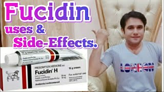 fucidin cream uses and side effects [upl. by Darla]