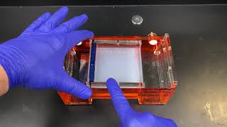 Agarose Gel Electrophoresis [upl. by Nilyam]