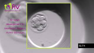 TimeLapse  Embryo development ENG first 100 hours [upl. by Jahdal]