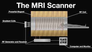 MRI Scan Animation  How magnetic resonance imaging works [upl. by Tome291]