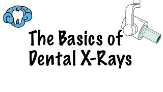 How to Read Dental XRays [upl. by Hsital]