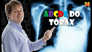 COMO AVALIAR QUALQUER RAIO X DO TÓRAX COM SEGURANÇA O ABCDE DO TÓRAX I VOCÊ RADIOLOGISTA [upl. by Leifeste]