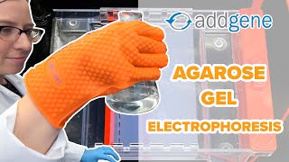 Agarose Gel Electrophoresis [upl. by Jaella552]