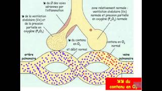 Semiologie de linsuffisance respiratoire Partie 1 [upl. by Milka]