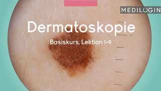 Dermatoskopie Basiskurs  MEDILOGIN [upl. by Lenehc]