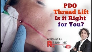 PDO Thread Lift Vs Facelift PDO Thread Lift Before After [upl. by Niawtna]