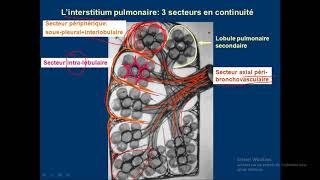 syndrome interstitiel en détails 01 [upl. by Belanger]