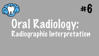 Oral Radiology  Radiographic Interpretation  INBDE ADAT [upl. by Leverick664]