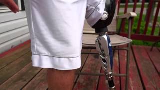 AmputeeOT How An Above Knee AK Prosthetic Leg Works [upl. by Garneau]