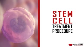 Stem Cell Treatment Procedure [upl. by Yeltnarb]