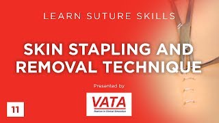 Skin Stapling and Removal Technique  Learn Suture Techniques  VATA [upl. by Eerized]