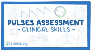 Clinical Skills Pulses assessment [upl. by Ardelis966]