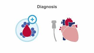 Endocarditis 101 Diagnosis and Treatment [upl. by Nylidnarb]