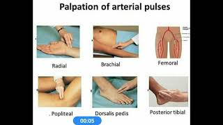 Sites Of Arterial Pulses [upl. by Galasyn]